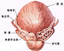 前列腺增生的症状图片